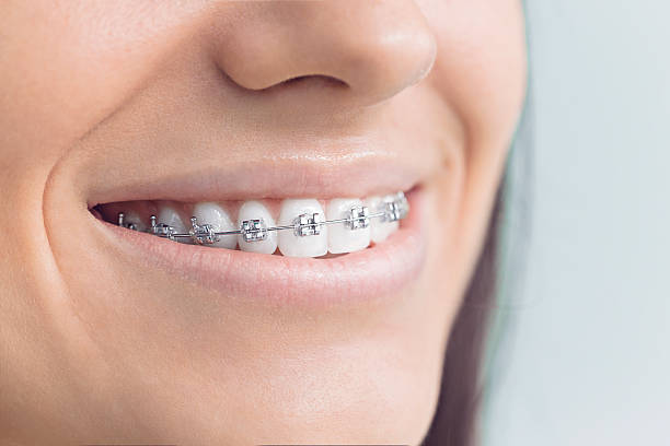 Why Choose Us for Your Dental Needs in Pittsfield, IL